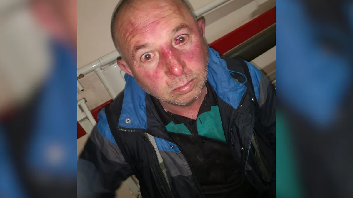 Səfirlik Kiyevdə azərbaycanlıların döyülməsi faktını nəzarətə götürüb - VİDEO - YENİLƏNİB