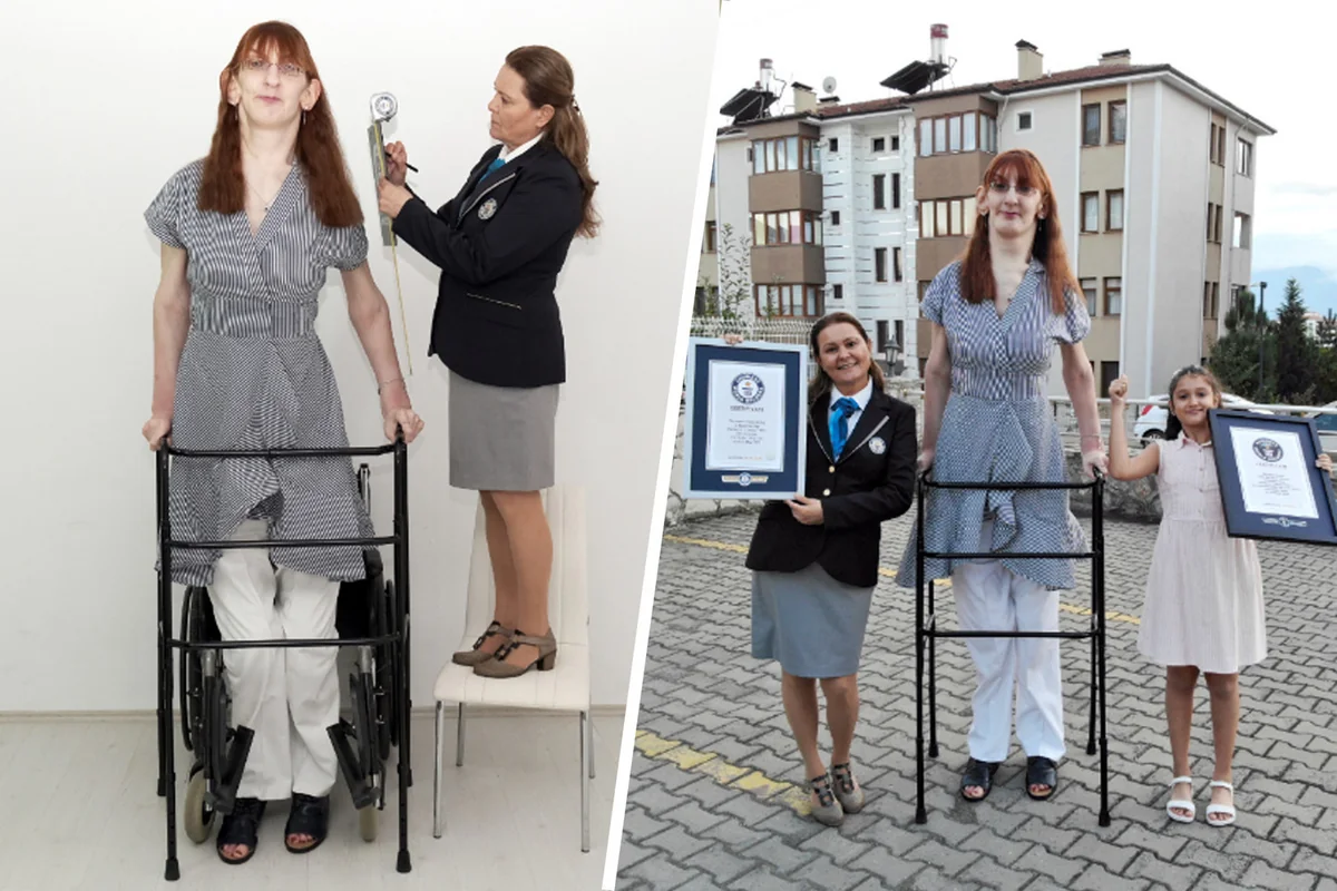 Turkish citizen confirmed as tallest woman 