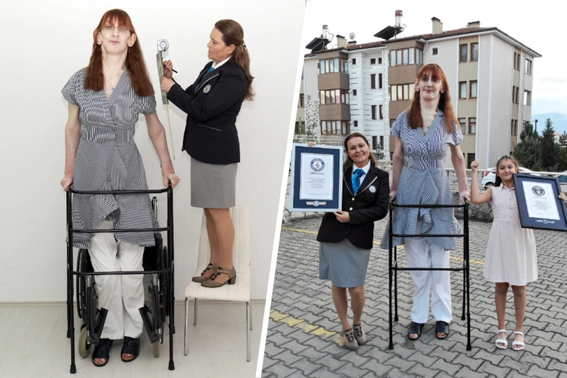 Turkish citizen confirmed as tallest woman 