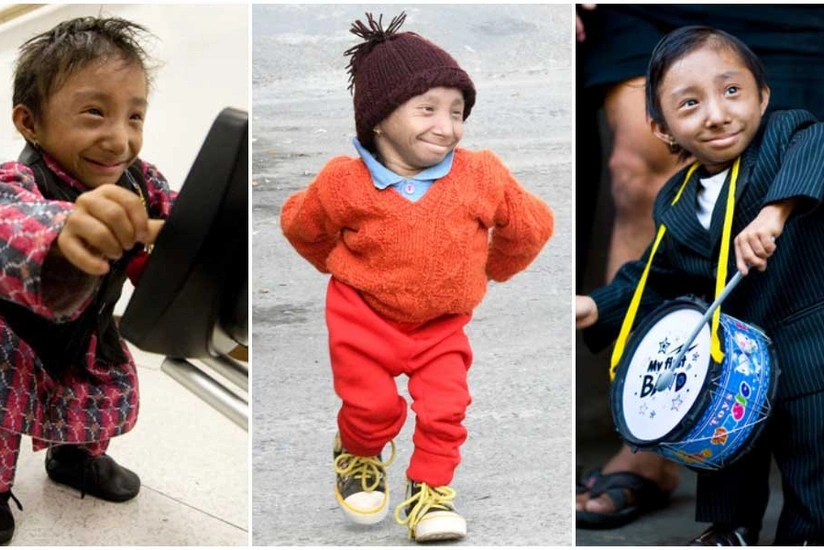 Умер самый маленький в мире человек - ФОТО - ВИДЕО