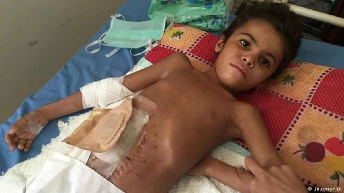 8,000 children killed or injured in conflicts worldwide