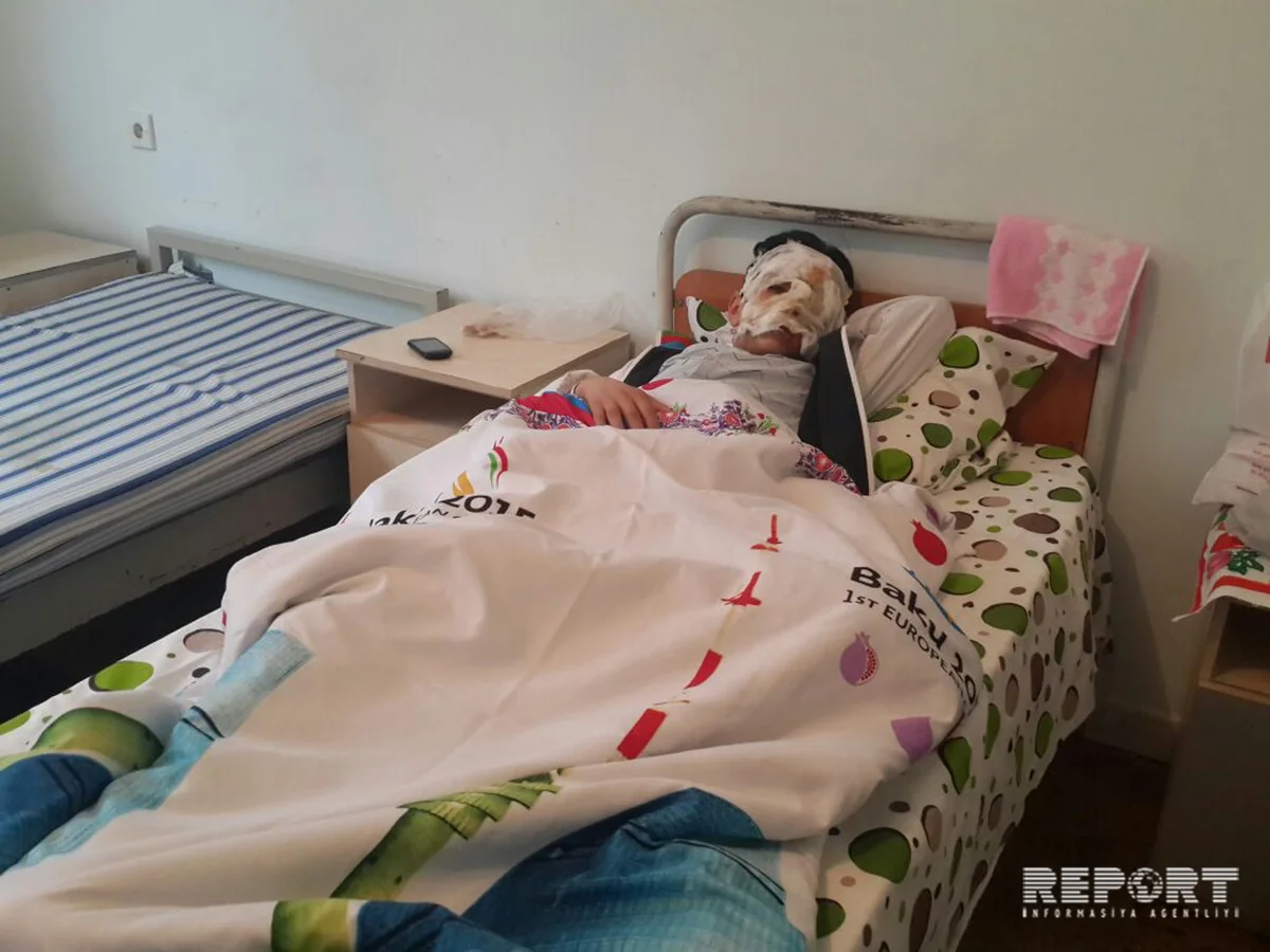 Od çərşənbəsində ocaq qalayan məktəblinin üzü yanıb - FOTO