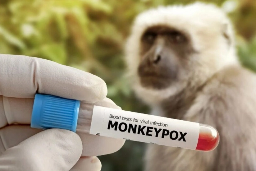 BƏƏ Afrika ölkələrinə meymunçiçəyinə qarşı vaksinlər bağışlayacaq