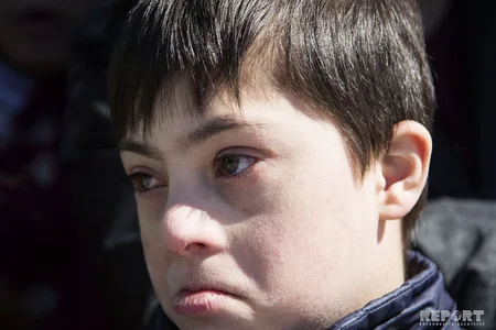 Bu gün Beynəlxalq Daun Sindromu Günüdür - FOTOREPORTAJ