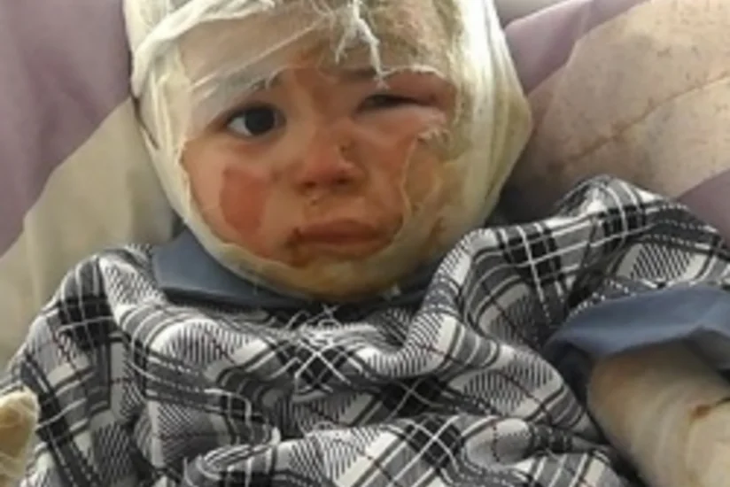 ​Rusiyada borca görə azərbaycanlının iki yaşlı övladı yandırılıb - FOTO - VİDEO
