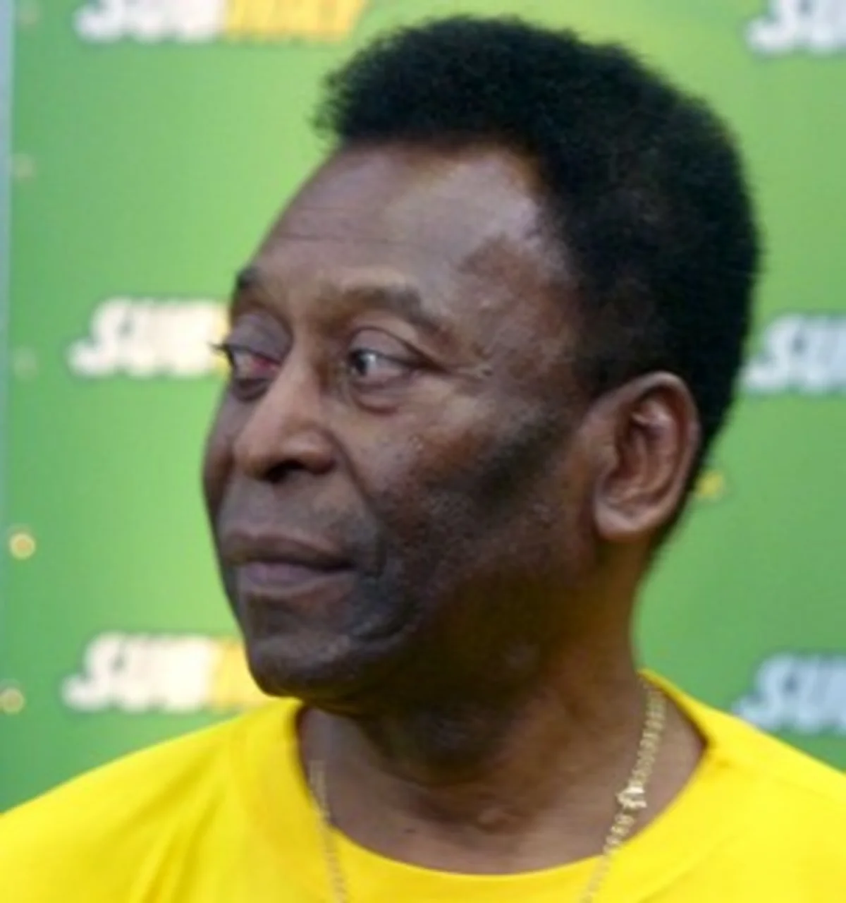 Pele hospitalized