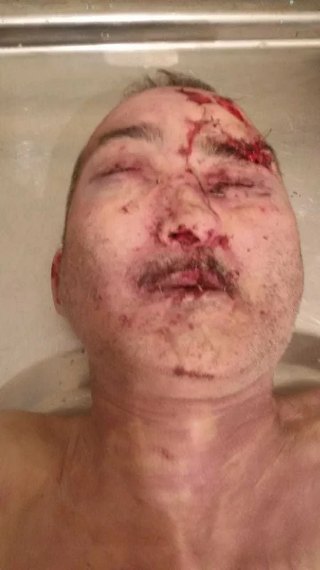 Goranboyda avtomobilin vuraraq öldürdüyü piyadanın yaxınları axtarılır - FOTO - YENİLƏNİB