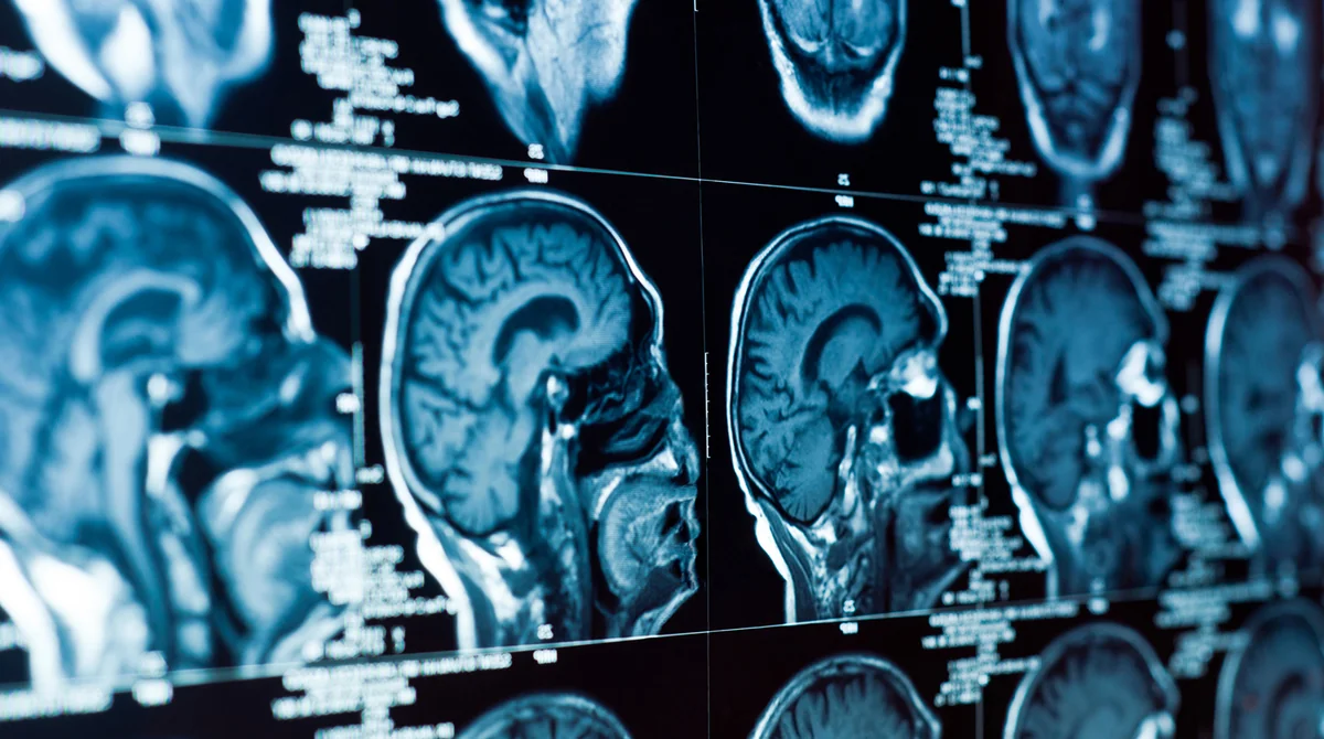 Scientists discover mysterious organ lurking in human head
