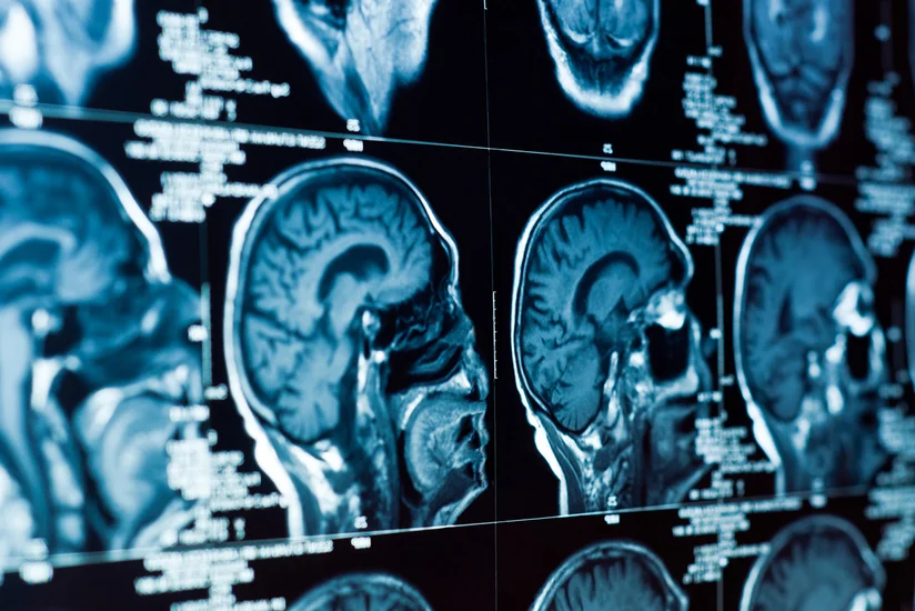 Scientists discover mysterious organ lurking in human head