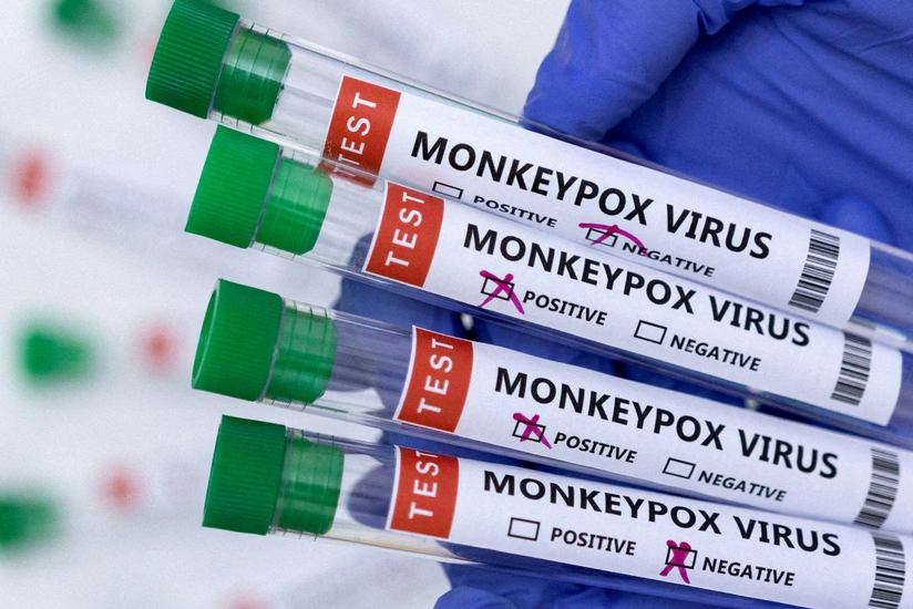 TƏBİB назвал способы избежать заражения оспой обезьян