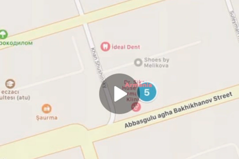 Electronic Security Service: Armenia continues provocations with Periscope