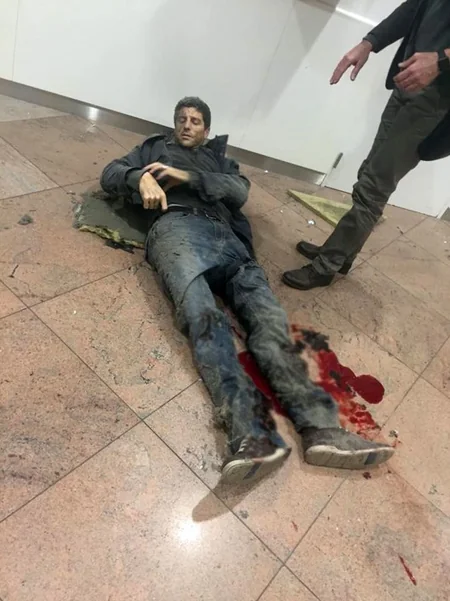 ​Brüsseldə terror aktları nəticəsində ölənlərin sayı 34 nəfərə çatıb