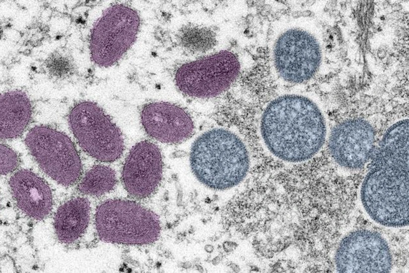 В Африке объявили чрезвычайную ситуацию в здравоохранении в связи с mpox