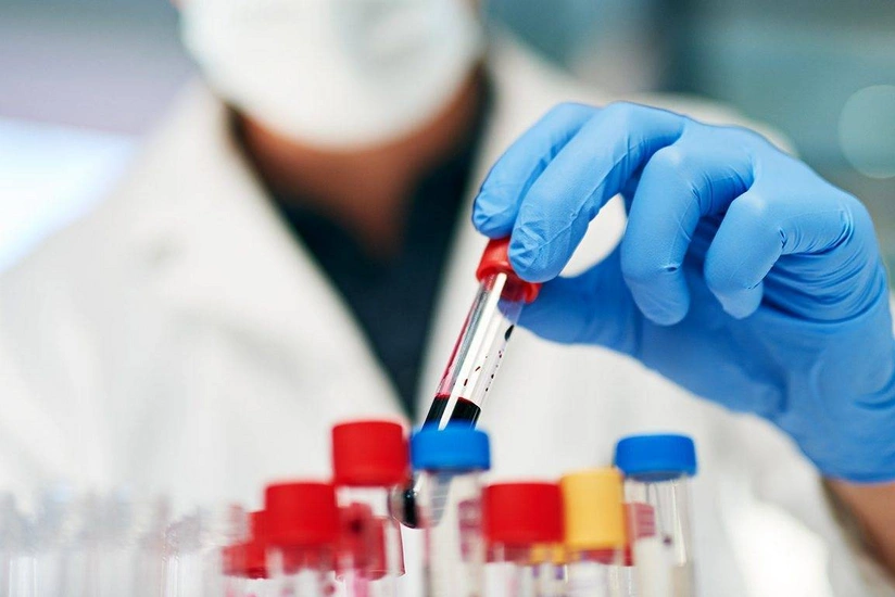 Omicron strain not detected in Azerbaijan
