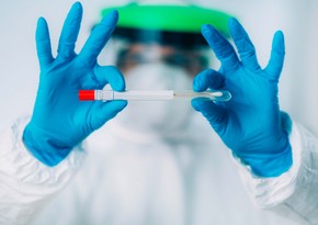 Azerbaijan confirms 995 new coronavirus cases, 29 died