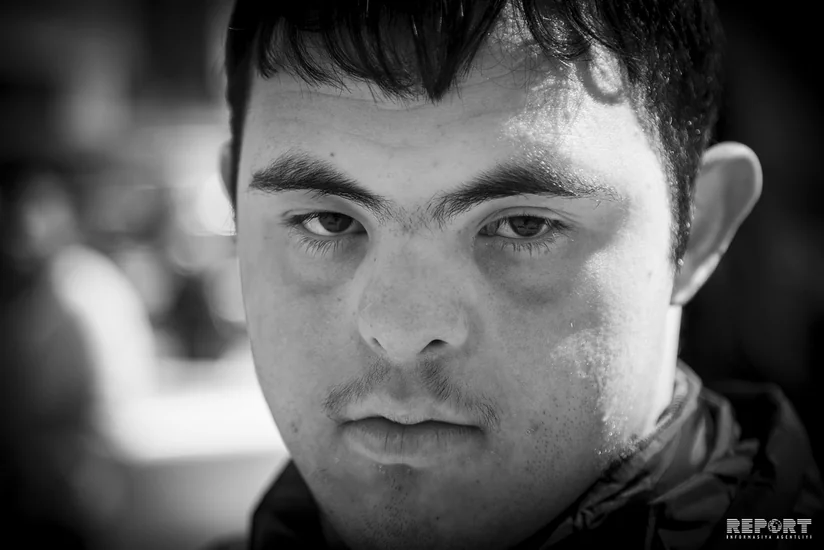 Bu gün Beynəlxalq Daun Sindromu Günüdür - FOTOREPORTAJ