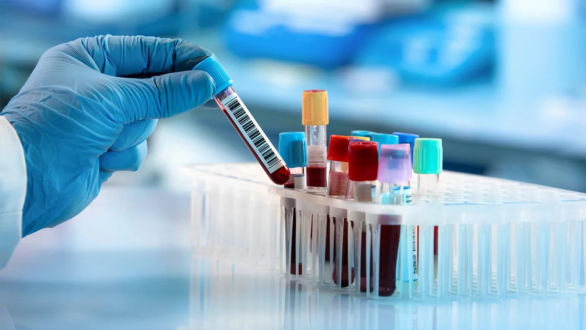 TƏBİB: Qanda anticismin yoxlanılması üçün ölkəyə 10 minə yaxın test gətirilib