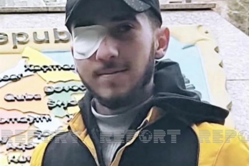 Vətən müharibəsinin rəssam qazisi gözündən əməliyyat ediləcək - FOTO