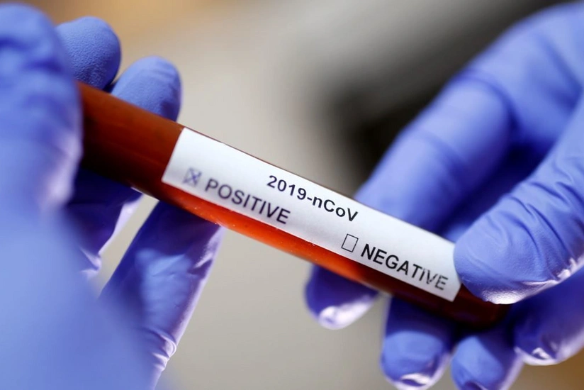 İranda koronavirus qurbanlarının sayı 7 minə çatdı