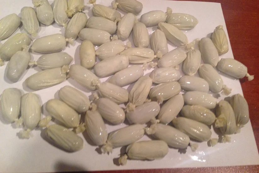 İrandan gələn Azərbaycan vətəndaşının daxili orqanında üç bağlama tiryək aşkar edilib