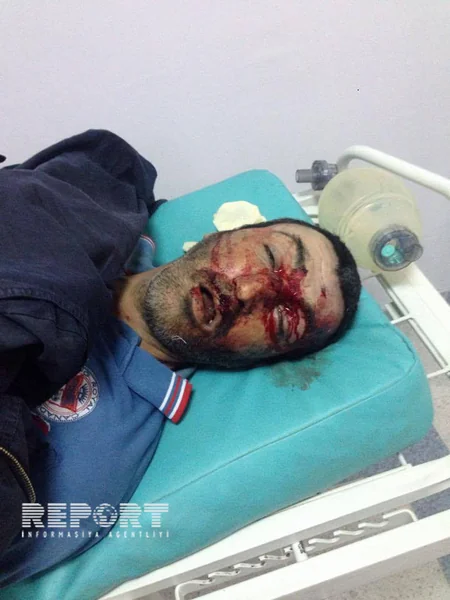Bakıda motosikletlə vurularaq öldürülən piyadanın şəxsiyyətini müəyyənləşdirmək mümkün olmayıb - FOTO - VİDEO - YENİLƏNİB