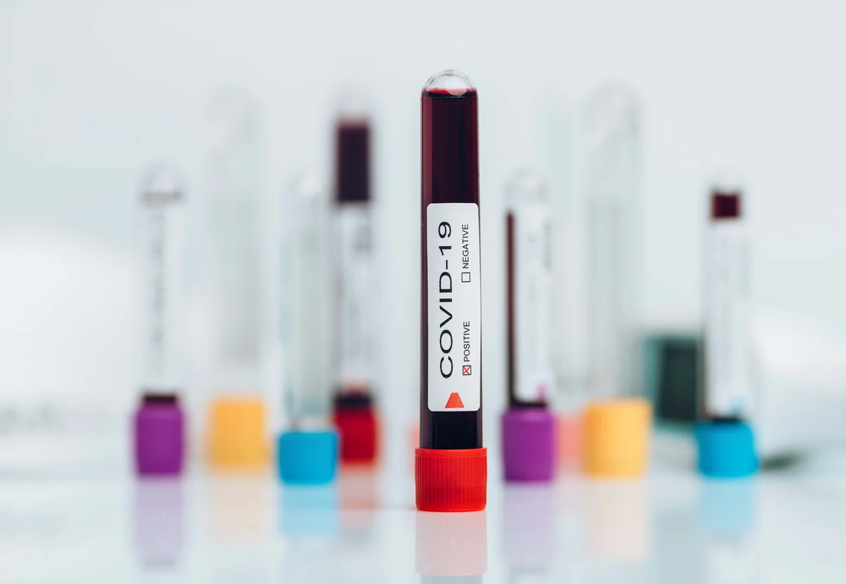 COVID-19: Azerbaijan confirms 714 COVID-19 cases