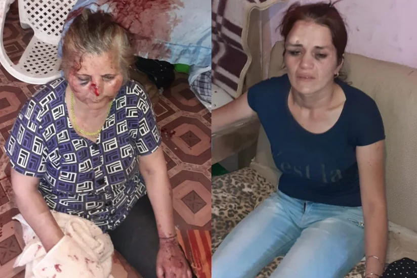 Buzovnada qaynanasını döyməkdə şübhəli bilinən kürəkən saxlanılıb - FOTO