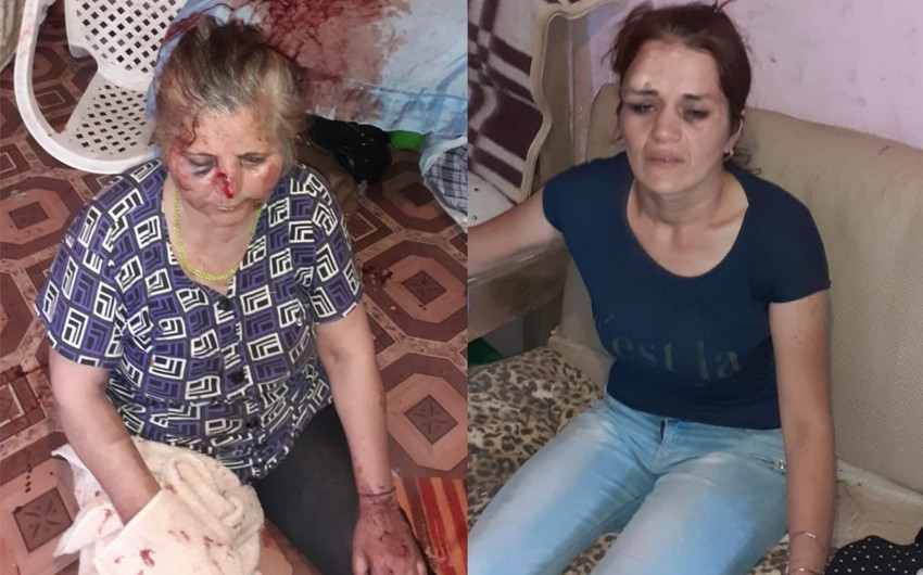 Buzovnada qaynanasını döyməkdə şübhəli bilinən kürəkən saxlanılıb - FOTO