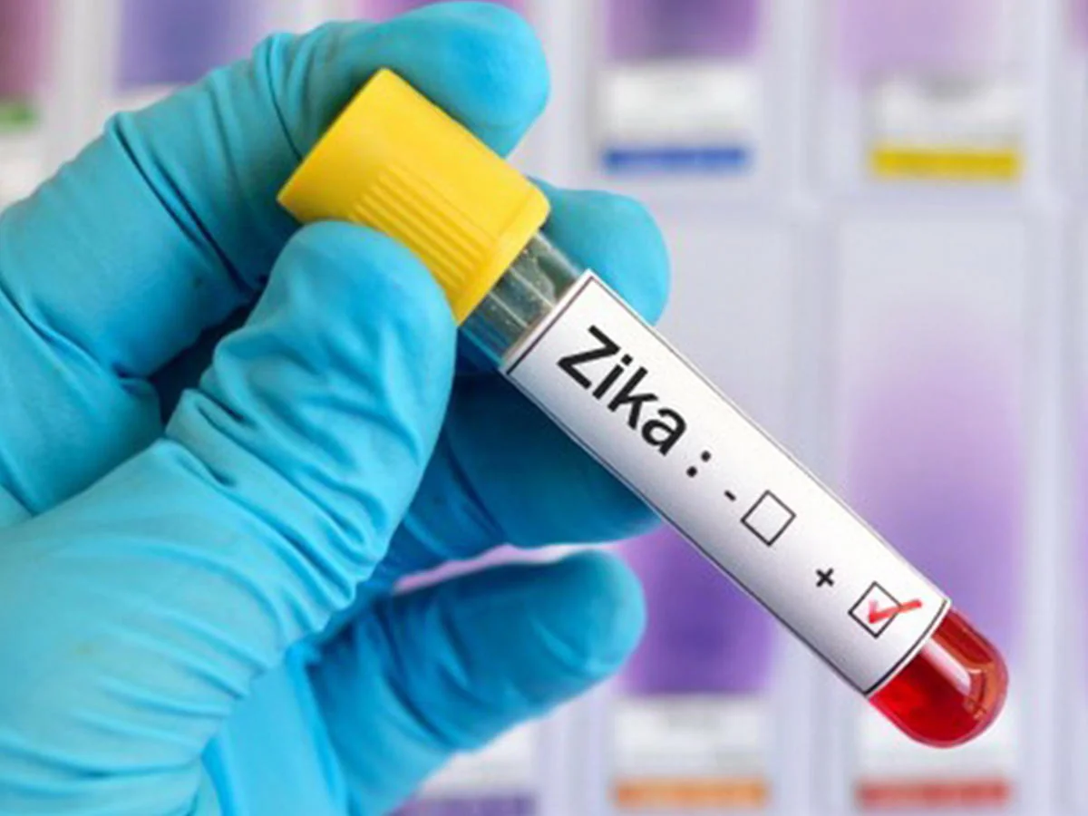 Rumıniyada Zika virusuna ilk yoluxma faktı qeydə alınıb