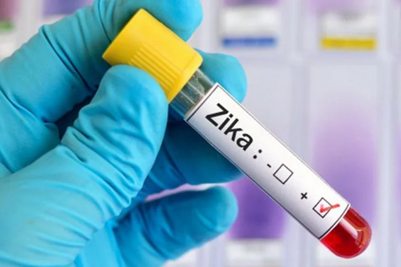 Rumıniyada Zika virusuna ilk yoluxma faktı qeydə alınıb