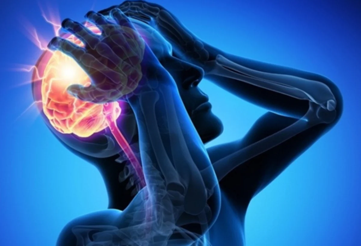 Stroke cases in Iran 1.5 times higher than global average