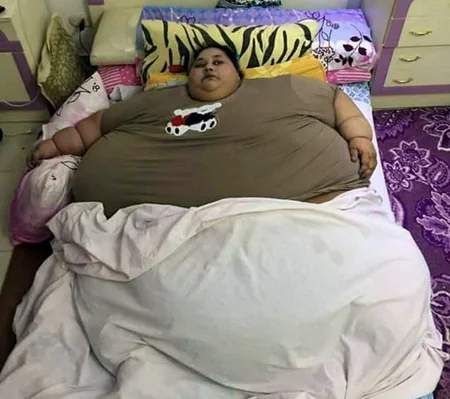 Dünyanın ən kök qadını 5 həftəyə 140 kq. arıqlayıb