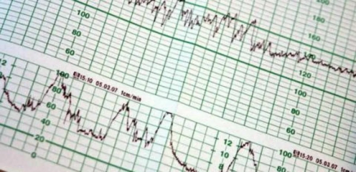 ​Türkiyədə 4,5 bal gücündə zəlzələ baş verib