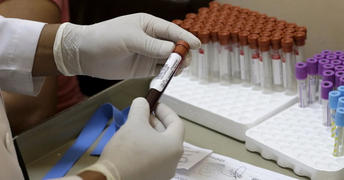 Ümumdünya Səhiyyə Təşkilatı: Zika virusuna qarşı mübarizə üçün 56 milyon dollar tələb olunur