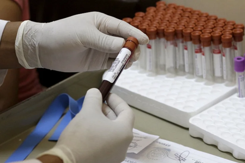 Ümumdünya Səhiyyə Təşkilatı: Zika virusuna qarşı mübarizə üçün 56 milyon dollar tələb olunur