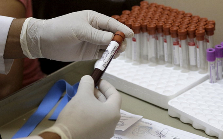 Ümumdünya Səhiyyə Təşkilatı: Zika virusuna qarşı mübarizə üçün 56 milyon dollar tələb olunur