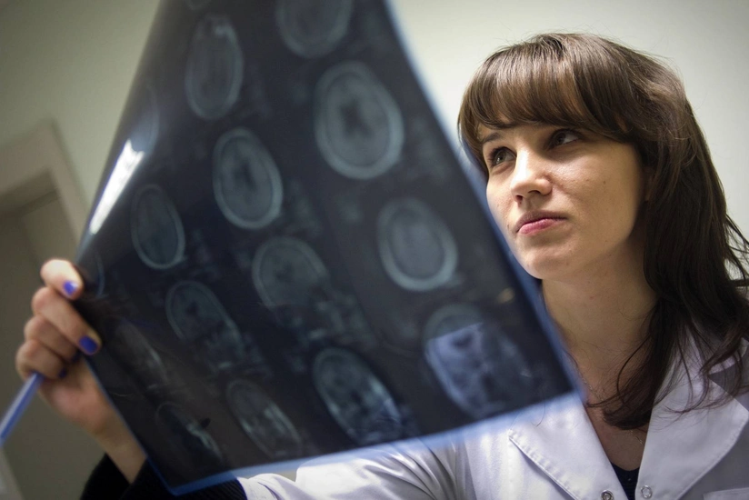 В человеческом мозге обнаружили микропластик