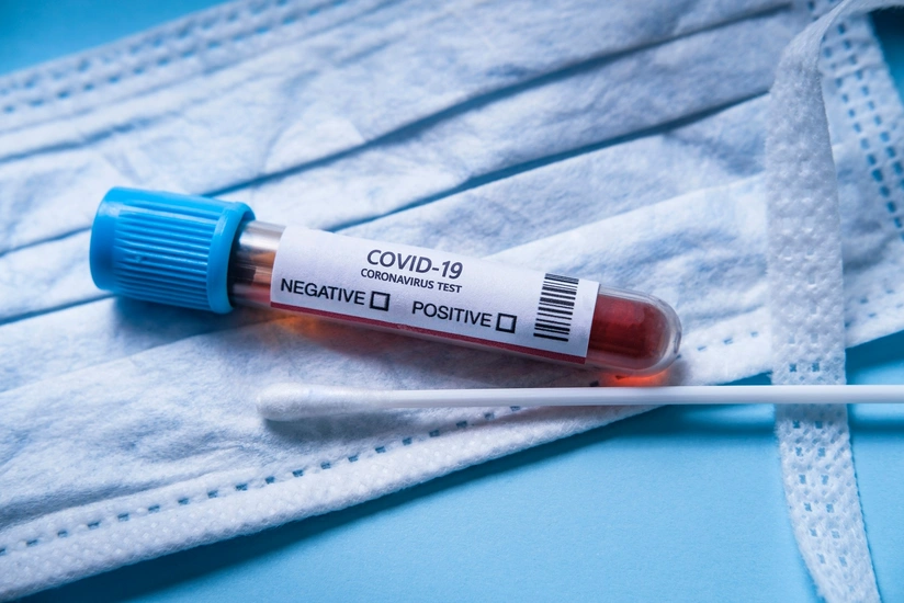 Azərbaycan Mərkəzi Bankının əməkdaşları koronavirus testi verəcək