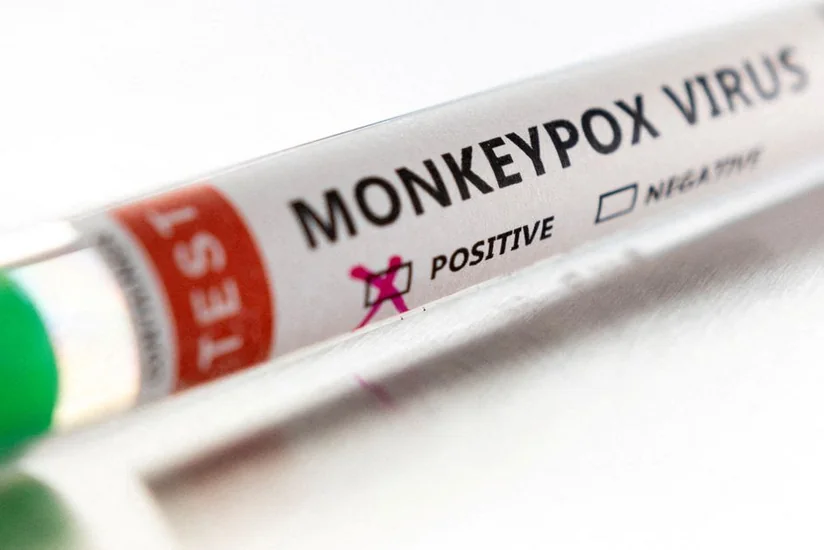 На Тайване зафиксировали первый случай заболевания оспой обезьян среди людей