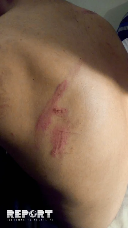 Şamaxıda 17 yaşlı gənc qayadan yıxılıb - FOTO