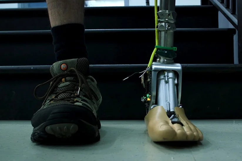 Regionlarda səyyar protez-ortopedik bərpa xidməti təşkil edildi