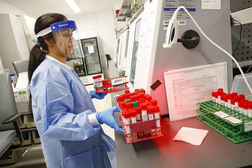 ABŞ-da koronavirusla bağlı testlərin sayı 10 milyonu keçdi