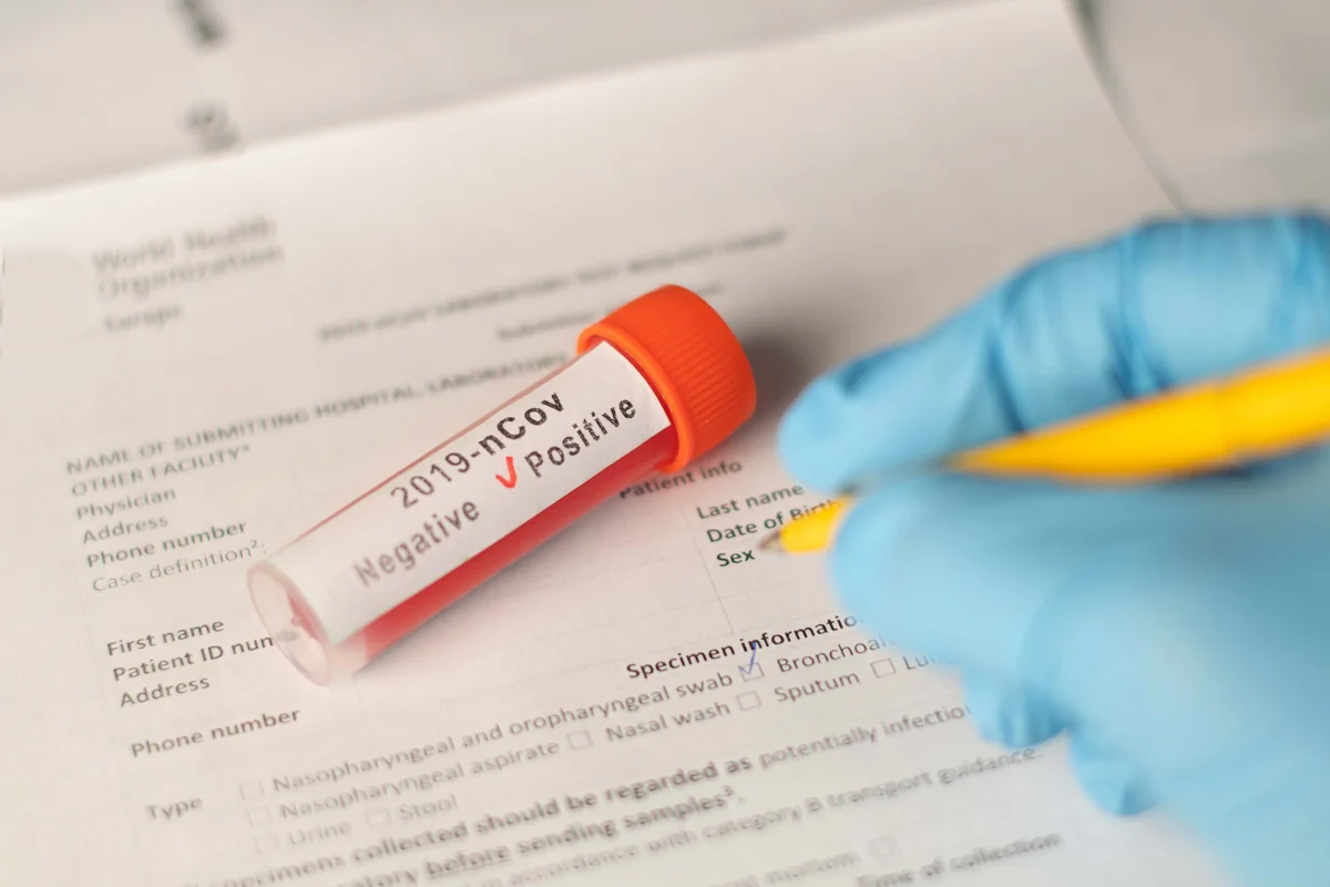 Gürcüstanda daha 958 nəfərdə koronavirus aşkarlanıb