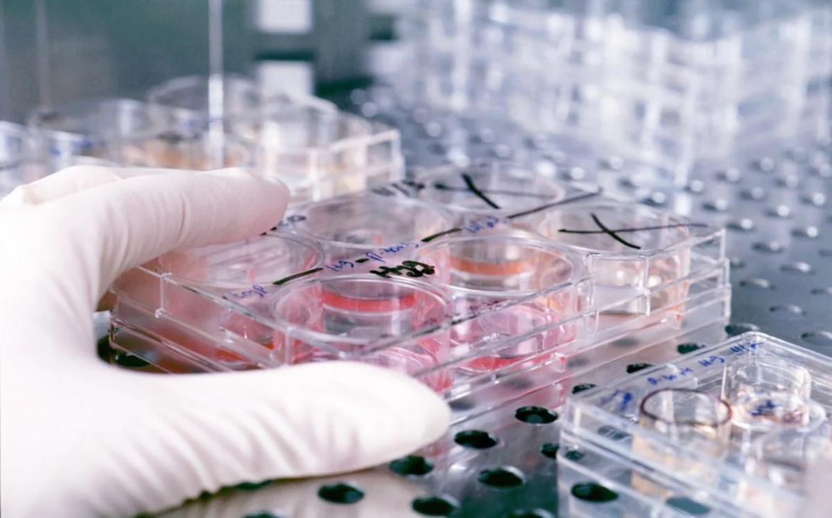 Azərbaycanda vərəmlə bağlı laboratoriya yaradılacaq