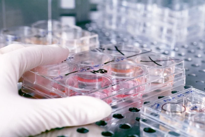 Azərbaycanda vərəmlə bağlı laboratoriya yaradılacaq