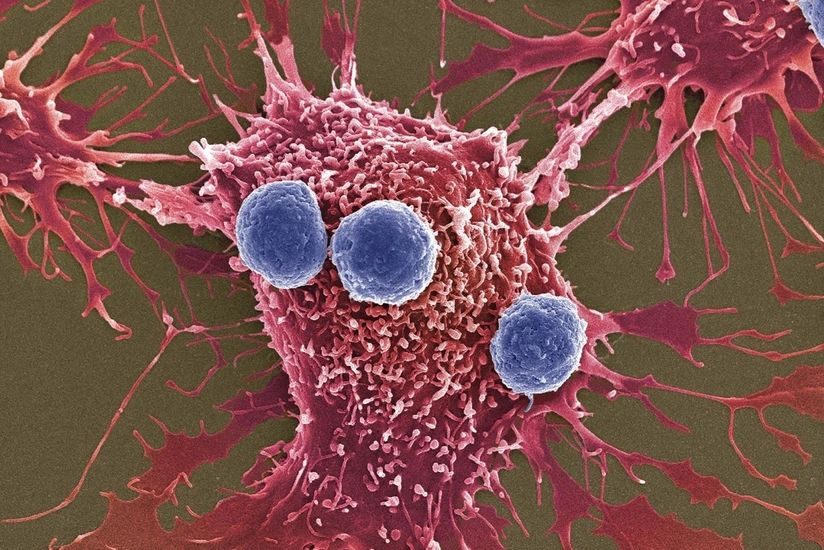 Scientists create drug that makes cancer treatment safer, cheaper