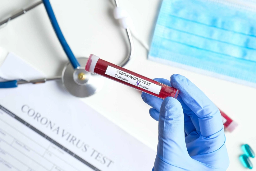 Azerbaijan confirms 660 new COVID-19 cases
