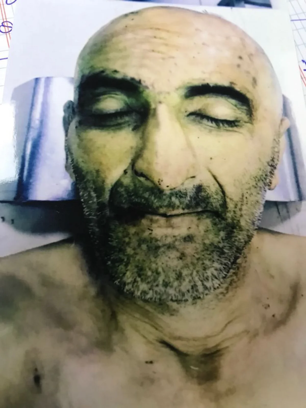 Polis Bakıda xəstəxanada ölən naməlum şəxsin yaxınlarını axtarır - FOTO