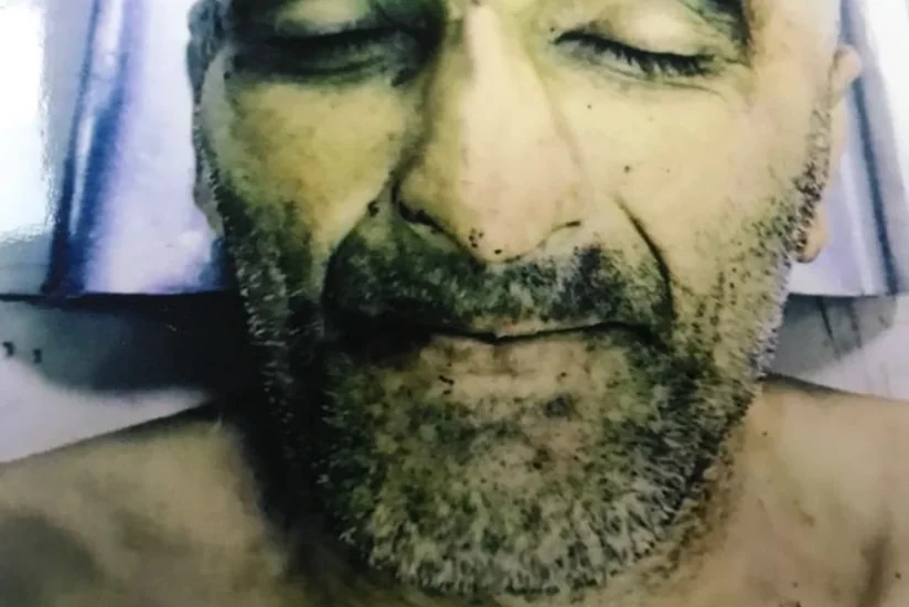 Polis Bakıda xəstəxanada ölən naməlum şəxsin yaxınlarını axtarır - FOTO