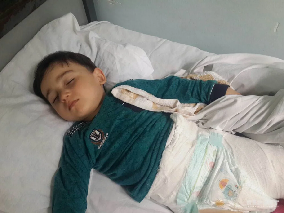 Sumqayıtda 3 yaşlı uşaq ikinci mərtəbədən yıxılaraq xəsarət alıb - FOTO
